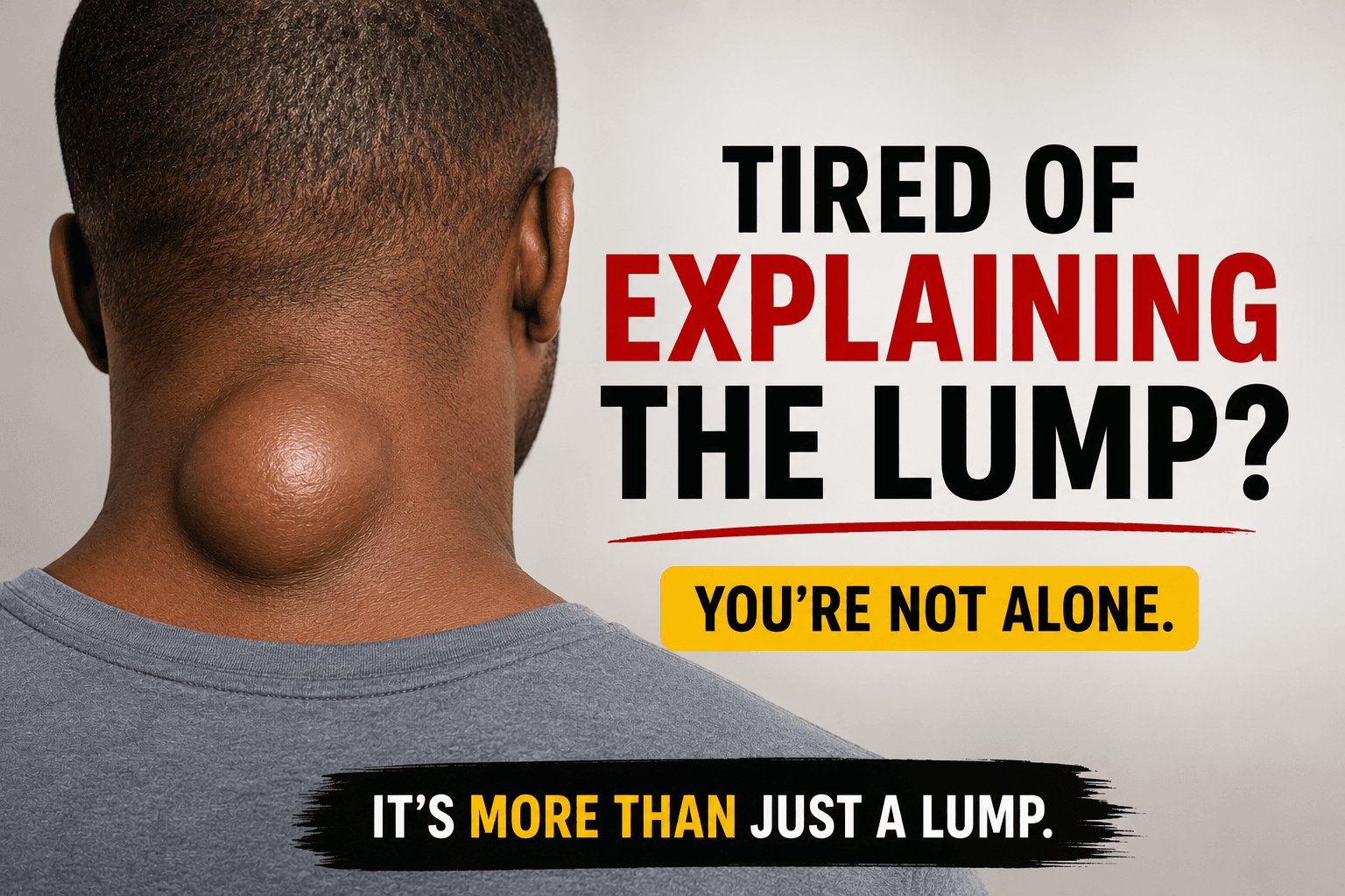 A visible lipoma under the skin